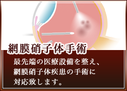 網膜硝子体手術